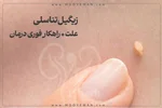 زگیل تناسلی و راهکارهای درمان آن